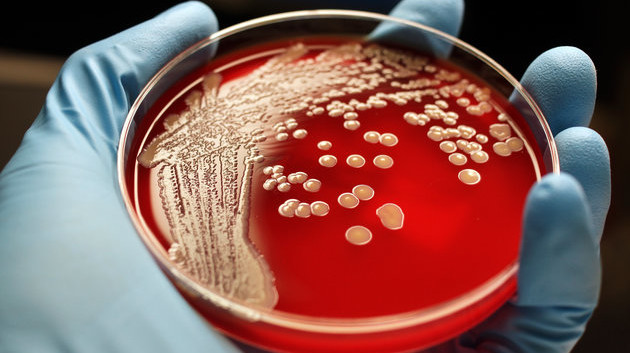 Siêu vi khuẩn kháng thuốc là kết quả của việc lạm dụng kháng sinh (Ảnh: R Parulan Jr./Getty Images )