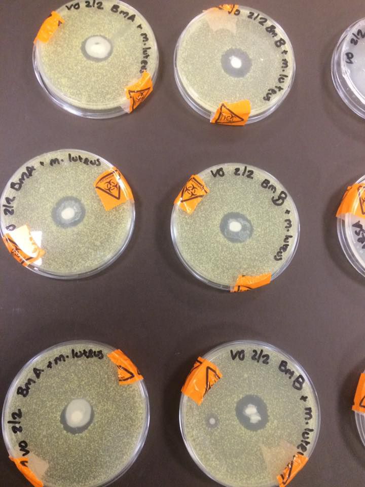 Tác dụng của sữa mẹ trên các đĩa thí nghiệm vi khuẩn (ảnh: Vicky Greene/Facebook)