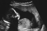 unborn-baby