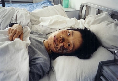 Khuôn mặt của Cao Dung Dung và mặt thật của cuộc bức hại tàn bạo tại TQ