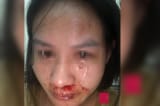 Một công an tại Hà Nội bị tố cáo hành hung vợ con